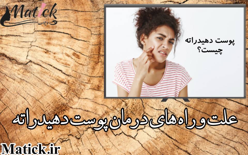 پوست دهیدراته
