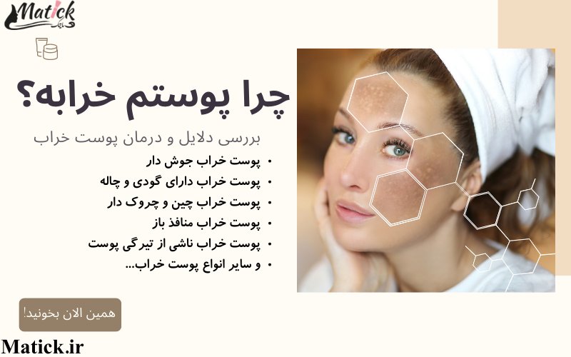 چرا پوستم خرابه؟