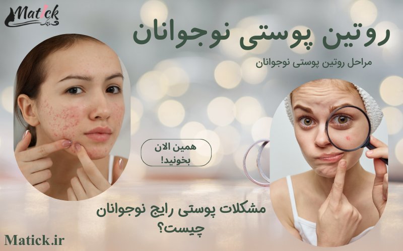 روتین پوستی نوجوانان